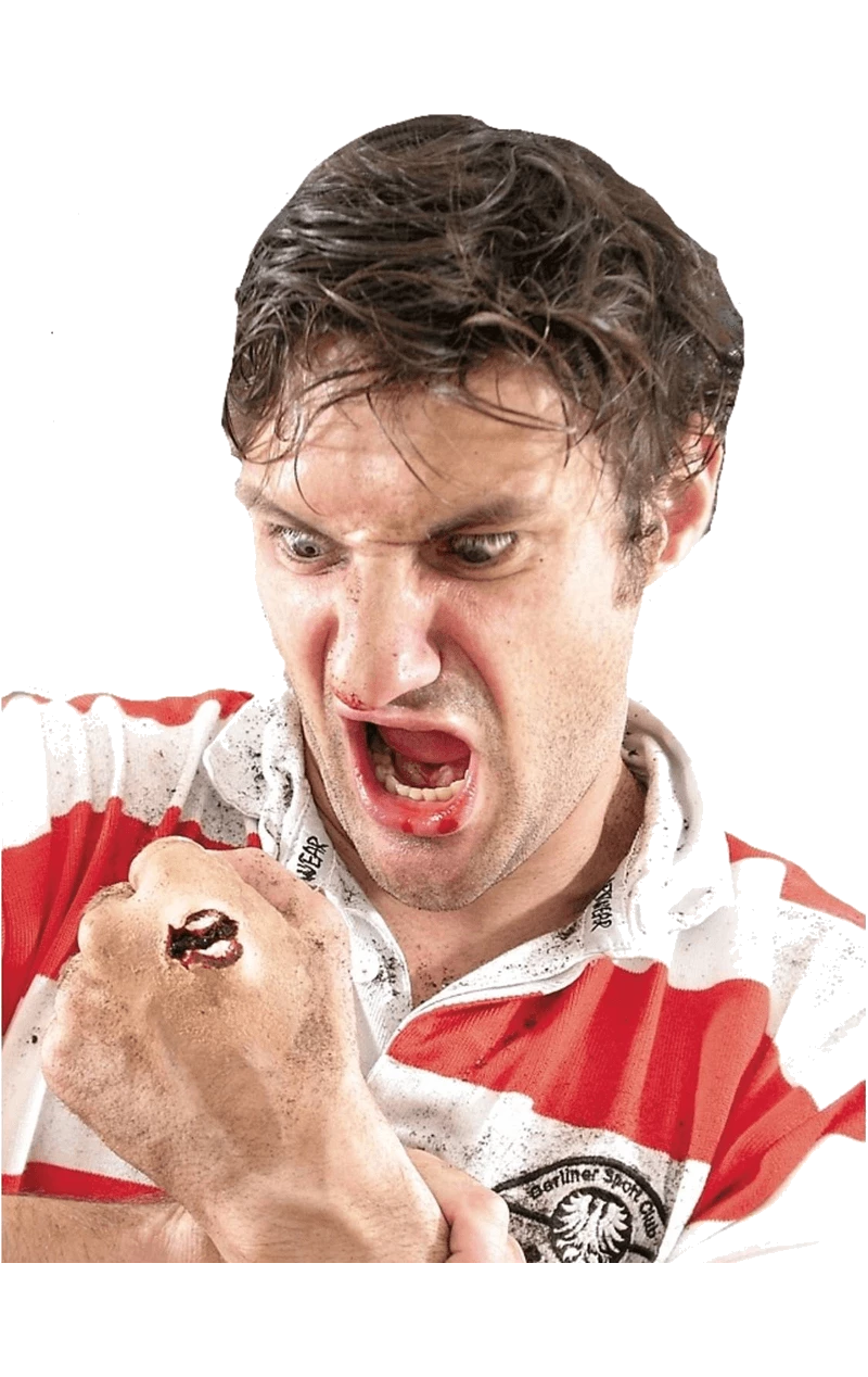 Compound Fracture SFX Kit 1 Compound Fracture SFX Kit